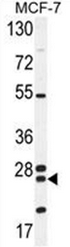 Western blot analysis of NUDT8 Antibody (N-term) in MCF-7 cell line lysates (35ug/lane). This demonstrates the NUDT8 antibody detected the NUDT8 protein (arrow).