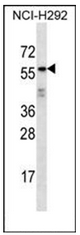 Western blot analysis of ODF2L Antibody (C-term) in NCI-H292 cell line lysates (35ug/lane). This demonstrates the ODF2L antibody detected the ODF2L protein (arrow).