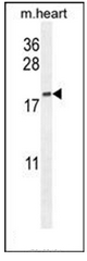 Western blot analysis of ODF3B Antibody (N-term) in mouse heart tissue lysates (35ug/lane). This demonstrates the ODF3B antibody detected the ODF3B protein (arrow). Western blot analysis of ODF3B Antibody (N-term) in mouse heart tissue lysates (35ug/lane). This demonstrates the ODF3B antibody detected the ODF3B protein (arrow).