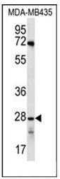 Western blot analysis of OR10AG1 Antibody (C-term) in MDA-MB435 cell line lysates (35ug/lane). This demonstrates the OR10AG1 antibody detected the OR10AG1 protein (arrow).