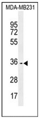 Western blot analysis of OR10Z1 Antibody (C-term) in MDA-MB231 cell line lysates (35ug/lane). This demonstrates the OR10Z1 antibody detected the OR10Z1 protein (arrow).