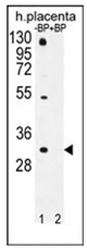 Western blot analysis of OR1D5 Antibody (C-term) pre-incubated without (Lane 1) and with (Lane 2) blocking peptide in human placenta tissue lysate. OR1D5 Antibody (C-term) (arrow) was detected using the purified Pab (1:60/250 dilution).