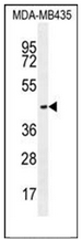 Western blot analysis of OR2L13 Antibody (C-term) in MDA-MB435 cell line lysates (35ug/lane). This demonstrates the OR2L13 antibody detected the OR2L13 protein (arrow).