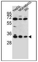 Western blot analysis of OR2T3 Antibody (C-term) in HepG2, MDA-MB453, 293 cell line lysates (35ug/lane). This demonstrates the OR2T3 antibody detected the OR2T3 protein (arrow).