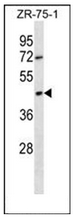Western blot analysis of OR2T6 Antibody (C-term) in ZR-75-1 cell line lysates (35ug/lane). This demonstrates the OR2T6 antibody detected the OR2T6 protein (arrow
