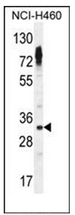 Western blot analysis of OR2Z1 Antibody (N-term) in NCI-H460 cell line lysates (35ug/lane). This demonstrates the OR2Z1 antibody detected the OR2Z1 protein (arrow).
