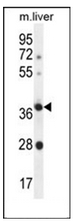 Western blot analysis of OR4A15 Antibody (C-term) in Mouse liver tissue lysates (35ug/lane). This demonstrates the OR4A15 antibody detected the OR4A15 protein (arrow).