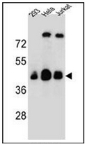 Western blot analysis of OR4C13 Antibody (N-term) in 293, Hela, Jurkat cell line lysates (35ug/lane). This demonstrates the OR4C13 antibody detected the OR4C13 protein (arrow).