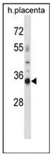Western blot analysis of OR4K13 Antibody (N-term) in human placenta tissue lysates (35ug/lane). This demonstrates the OR4K13 antibody detected the OR4K13 protein (arrow).