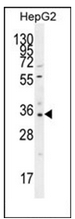 Western blot analysis of OR52I2 Antibody (C-term) in HepG2 cell line lysates (35ug/lane). This demonstrates the OR52I2 antibody detected the OR52I2 protein (arrow).