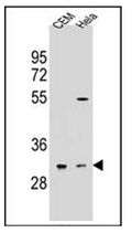 Western blot analysis of OR5L2 Antibody (N-term) in CEM, Hela cell line lysates (35ug/lane). This demonstrates the OR5L2 antibody detected the OR5L2 protein (arrow).