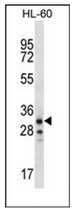 Western blot analysis of OR6K2 Antibody (C-term) in HL-60 cell line lysates (35ug/lane).This demonstrates the OR6K2 antibody detected the OR6K2 protein (arrow).