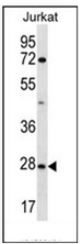 Western blot analysis of OR6T1 Antibody (C-term) in Jurkat cell line lysates (35ug/lane). This demonstrates the OR6T1 antibody detected the OR6T1 protein (arrow).