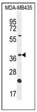 Western blot analysis of OR6V1 Antibody (C-term) in MDA-MB435 cell line lysates (35ug/lane). This demonstrates the OR6V1 antibody detected the OR6V1 protein (arrow).