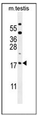 Western blot analysis of ORMDL3 Antibody (Center) in mouse testis tissue lysates (35ug/lane). This demonstrates the ORMDL3 antibody detected the ORMDL3 protein (arrow).
