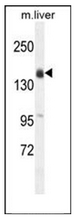 Western blot analysis of Otoancorin / OTOA Antibody (N-term) in mouse liver tissue lysates (35ug/lane). This demonstrates the OTOA antibody detected the OTOA protein (arrow).