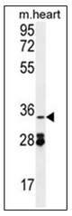 Western blot analysis of OXNAD1 Antibody (C-term) in mouse heart tissue lysates (35ug/lane). This demonstrates the OXNAD1 antibody detected the OXNAD1 protein (arrow). Western blot analysis of OXNAD1 Antibody (C-term) in mouse heart tissue lysates (35ug/lane). This demonstrates the OXNAD1 antibody detected the OXNAD1 protein (arrow).