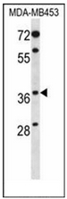Western blot analysis of PAQR8 Antibody (C-term) in MDA-MB453 cell line lysates (35ug/lane). This demonstrates the PAQR8 antibody detected the PAQR8 protein (arrow).