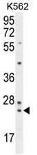 PAUF Antibody (Center) (Cat. #AP53174PU-N) western blot analysis in K562 cell line lysates (35g/lane).This demonstrates the PAUF antibody detected the PAUF protein (arrow).