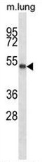 PBX2 Antibody (Center) western blot analysis in mouse lung tissue lysates (35ug/lane).This demonstrates the PBX2 antibody detected the PBX2 protein (arrow).