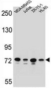 Western blot analysis in MDA-MB453, Jurkat, ZR-75-1, HL-60 cell line lysates (35ug/lane) using PCDHB15 antibody. (N-term). This demonstrates the PCDHB15 antibody detected the PCDHB15 protein (arrow).