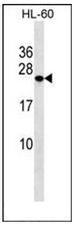 Western blot analysis of PCTP Antibody (Center) in HL-60 cell line lysates (35ug/lane). This demonstrates the PCTP antibody detected the PCTP protein (arrow).