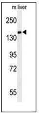 Western blot analysis of PDE6C Antibody (Center) in mouse liver tissue lysates (35ug/lane). PDE6C (arrow) was detected using the purified Pab.