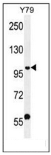 Western blot analysis of PHF20 Antibody (N-term) in Y79 cell line lysates (35ug/lane). This demonstrates the PHF20 antibody detected the PHF20 protein (arrow).