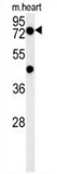 Western blot analysis in mouse heart tissue lysates (15ug/lane) using PHTF2 antibody. This demonstrates the PHTF2 antibody detected PHTF2 protein (arrow).