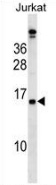 Western blot analysis in Jurkat cell line lysates (35ug/lane) using PLAC4 antibody. This demonstrates the PLAC4 antibody detected the PLAC4 protein (arrow).
