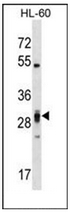 Western blot analysis of PLEKHF2 Antibody (Center) in HL-60 cell line lysates (35ug/lane). This demonstrates the PLEKHF2 antibody detected the PLEKHF2 protein (arrow).