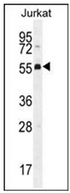 Western blot analysis of PODNL1 Antibody (Center) in Jurkat cell line lysates (35ug/lane). This demonstrates the PODNL1 antibody detected the PODNL1 protein (arrow).