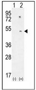 Western blot analysis of ZBP1 in mouse small intestine tissue lysate with ZBP1 antibody at (A) 0.5, (B) 1 and (C) 2ug/ml.