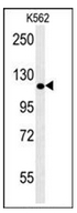 Western blot analysis of POTEE Antibody (Center) in K562 cell line lysates (35ug/lane). This demonstrates the POTEE antibody detected the POTEE protein (arrow).