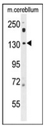 Western blot analysis of POTEF Antibody (Center) in mouse cerebellum tissue lysates (35ug/lane). This demonstrates the POTEF antibody detected the POTEF protein (arrow).