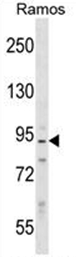 Western blot analysis of Neurabin-2 Antibody (N-term) in Ramos cell line lysates (35ug/lane). This demonstrates the PPP1R9B antibody detected the PPP1R9B protein (arrow).