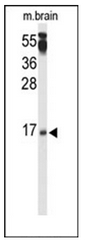 Western blot analysis of PPP3R2 / CBLP Antibody (N-term) in mouse brain tissue lysates (35ug/lane). PPP3R2 (arrow) was detected using the purified Pab.