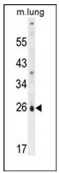 Western blot analysis of PQLC1 Antibody in mouse lung tissue lysates (35ug/lane). This demonstrates the PQLC1 antibody detected the PQLC1 protein (arrow).