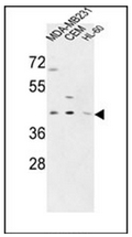 Western blot analysis of PRPF38A Antibody (C-term) in MDA-MB231, CEM, HL-60 cell line lysates (35ug/lane). This demonstrates the PR38A antibody detected the PR38A protein (arrow).