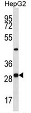 PROSC Antibody (C-term) western blot analysis in HepG2 cell line lysates (35ug/lane).This demonstrates the PROSC antibody detected the PROSC protein (arrow).
