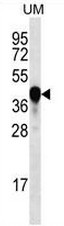 PROX2 Antibody (C-term) western blot analysis in UM cell line lysates (35ug/lane).This demonstrates the PROX2 antibody detected the PROX2 protein (arrow).
