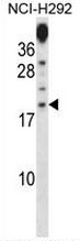 Western blot analysis in NCI-H292 cell line lysates (35ug/lane) using PRR15 antibody. (C-term). This demonstrates the PRR15 antibody detected the PRR15 protein (arrow).