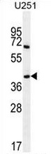Western blot analysis in U251 cell line lysates (35ug/lane) using Proline-rich protein 16 / PRR16 antibody. (C-term). This demonstrates the PRR16 antibody detected the PRR16 protein (arrow).