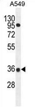 Western blot analysis in A549 cell line lysates (35ug/lane) using PRR19 antibody. This demonstrates the PRR19 antibody detected the PRR19 protein (arrow).