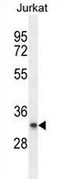 Western blot analysis in Jurkat cell line lysates (35ug/lane) using PRRG3 antibody. This demonstrates the PRRG3 antibody detected the PRRG3 protein (arrow).