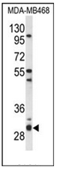 Western blot analysis of PSMG2 Antibody (C-term) in MDA-MB468 cell line lysates (35ug/lane). PSMG2 (arrow) was detected using the purified Pab. Western blot analysis of PSMG2 Antibody (C-term) in MDA-MB468 cell line lysates (35ug/lane). PSMG2 (arrow) was detected using the purified Pab.