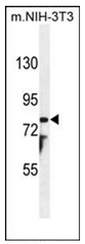 Western blot analysis of PTCHD1 Antibody (Center) in mouse NIH-3T3 cell line lysates (35ug/lane). This demonstrates the PTCHD1 antibody detected the PTCHD1 protein (arrow).