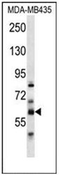 Western blot analysis of PTDSS2 Antibody (N-term) in MDA-MB435 cell line lysates (35ug/lane). This demonstrates the PTDSS2 antibody detected the PTDSS2 protein (arrow).