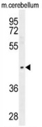 western blot analysis in mouse cerebellum tissue lysates (35ug/lane) using PTOV1 antibody. (N-term). This demonstrates the PTOV1 antibody detected the PTOV1 protein (arrow).