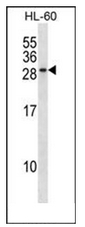 Western blot analysis of RAB15 Antibody (Center) in HL-60 cell line lysates (35ug/lane). This demonstrates the RAB15 antibody detected the RAB15 protein (arrow).